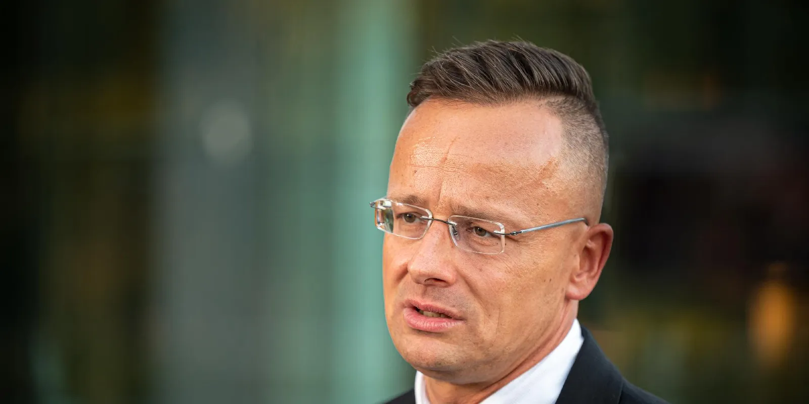 Egyértelmű,  kinek a győzelmével végződik az ukrajnai háború