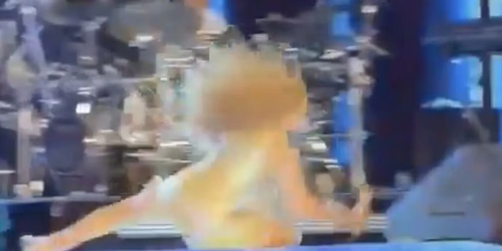 Shakira csúnya balesetet szenvedett a színpadon