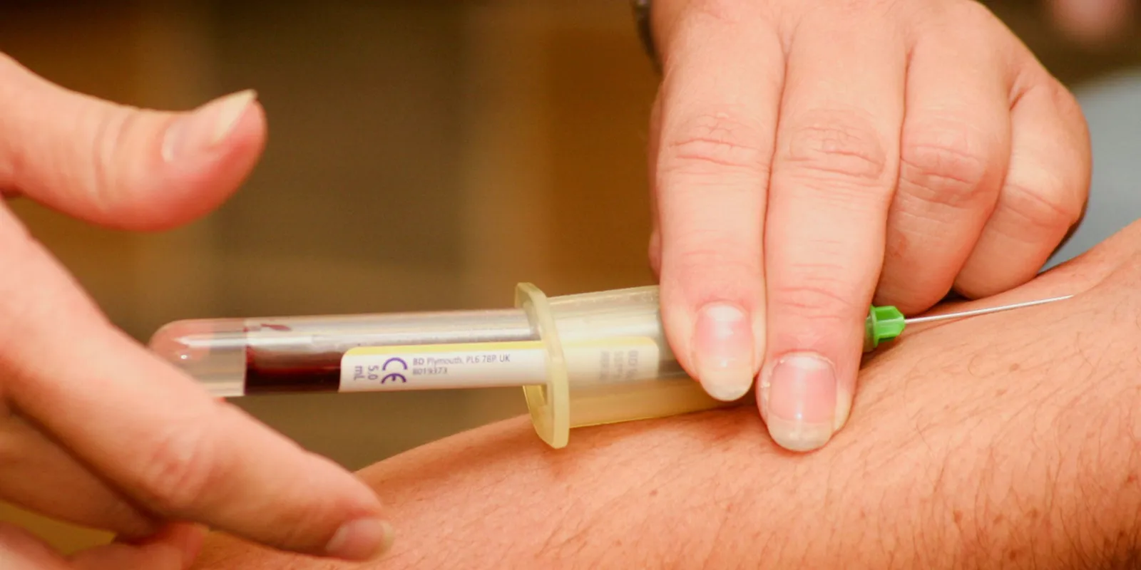 Megérkezett Magyarország első „piócarobotja”