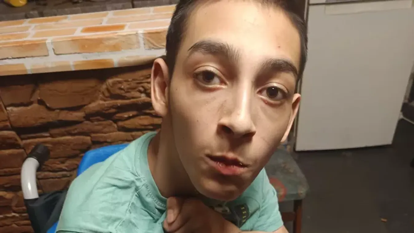 Gyula intenzív terápiára szorul, hogy önállóan járhasson