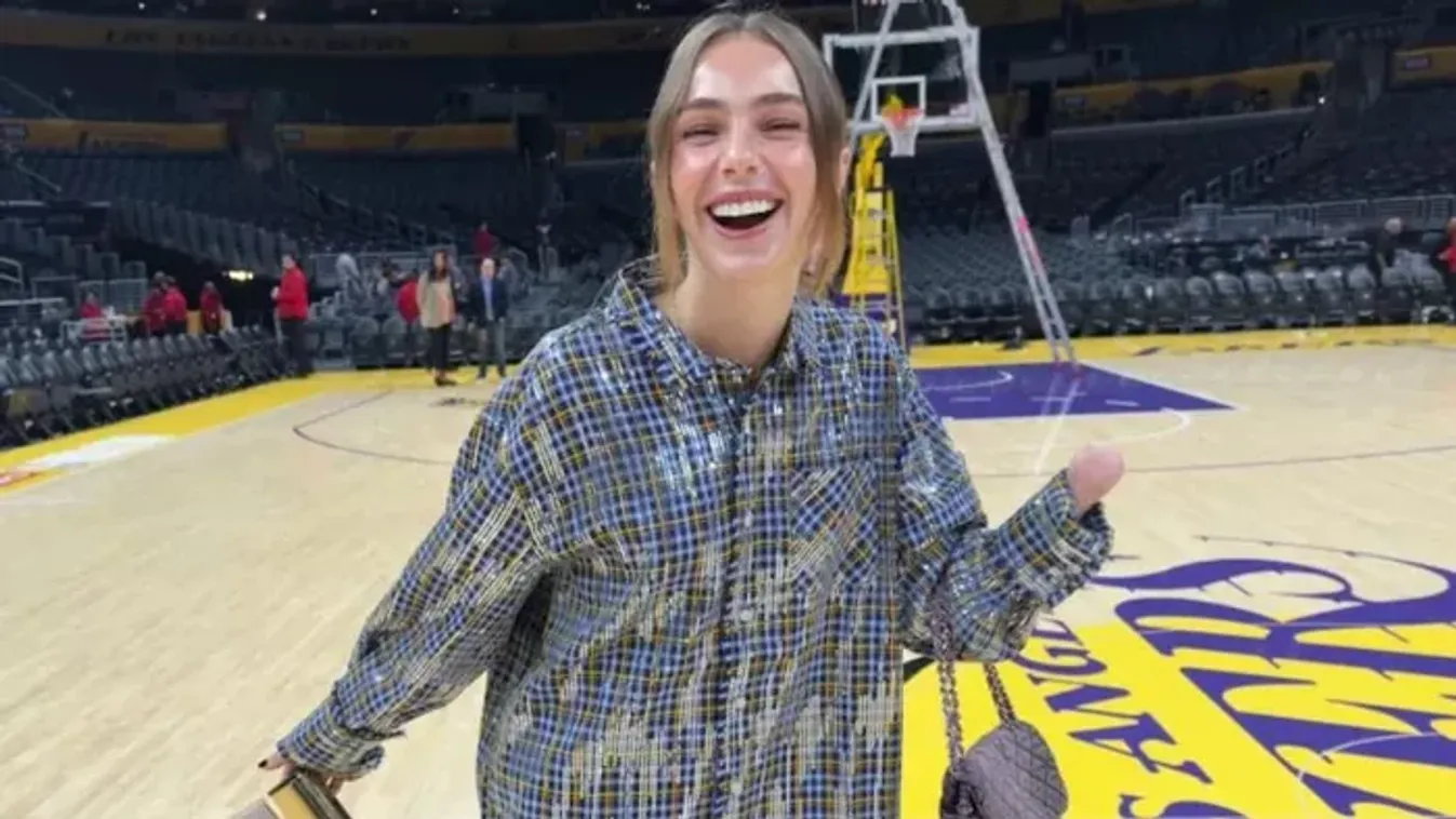 Ujjak nélkül született, így éli az életét a fiatal nő