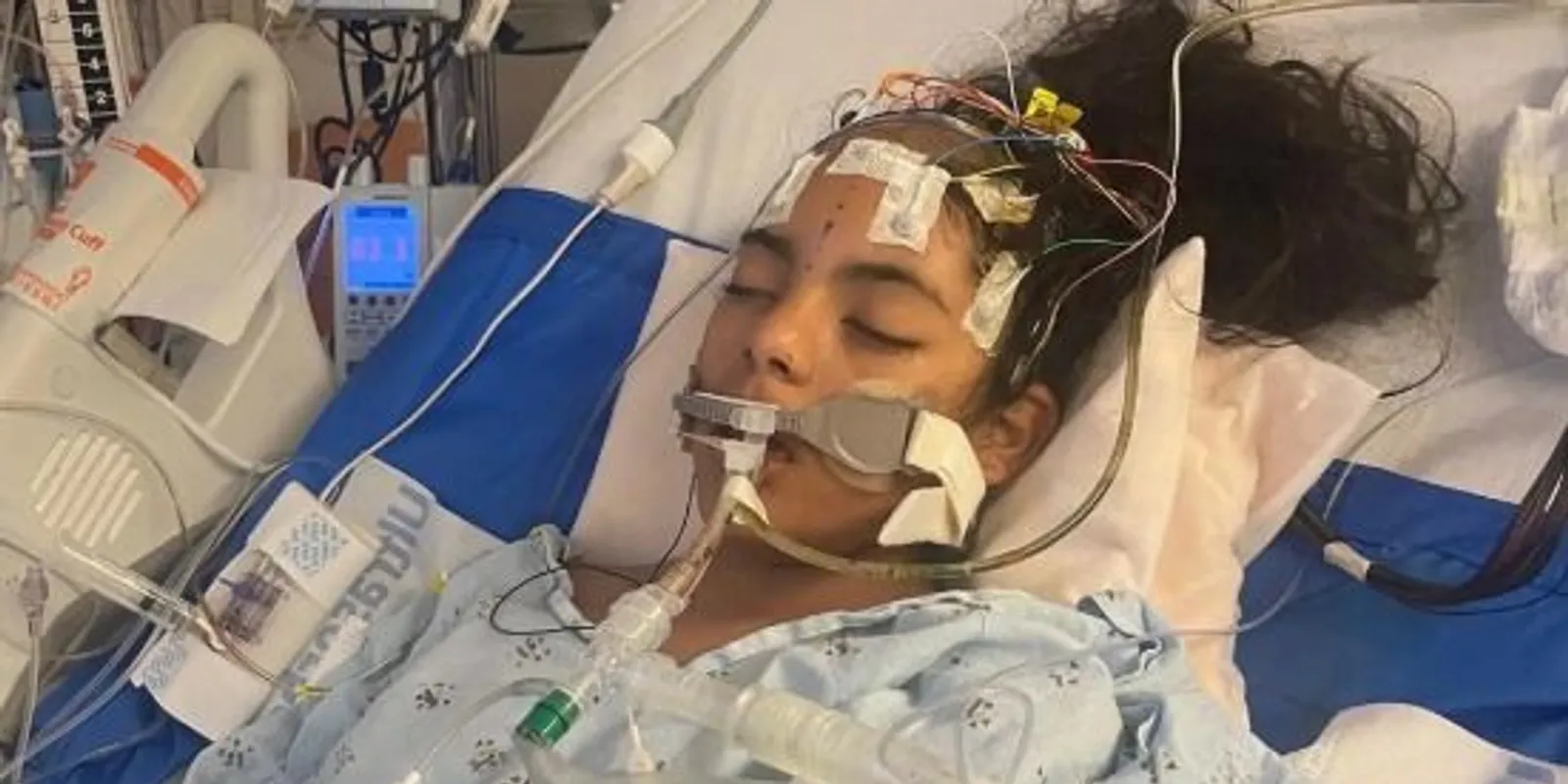 Meghalt a 12 éves lány, miután fejbe dobták egy palackkal