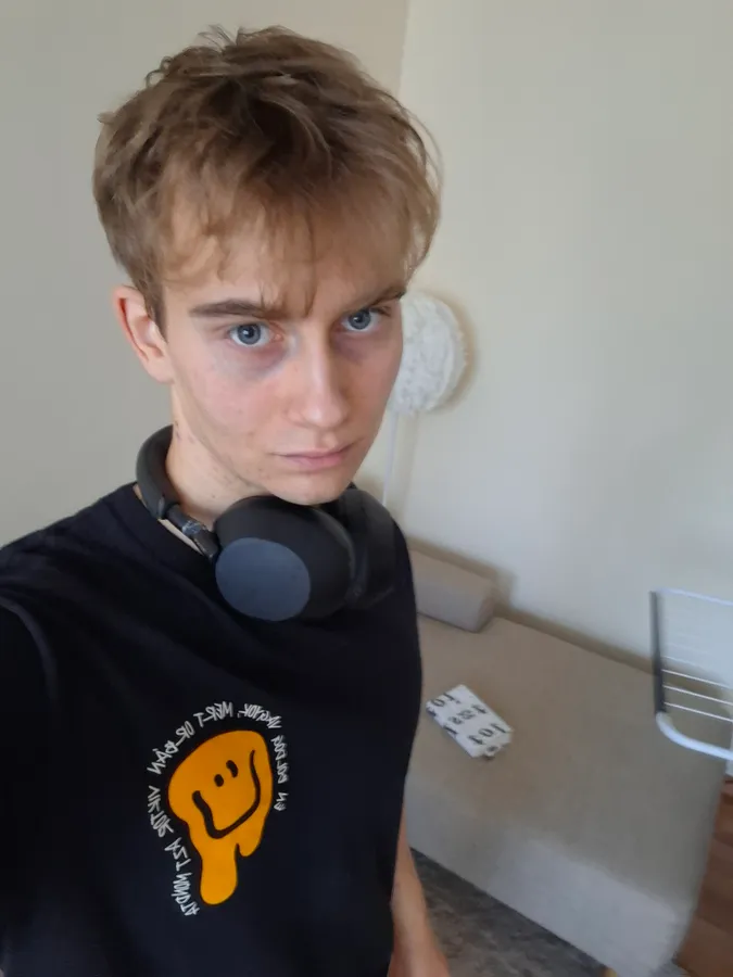 Bálint rengeteget fogyott a kemoterápia alatt, a sportot is abba kellett hagynia