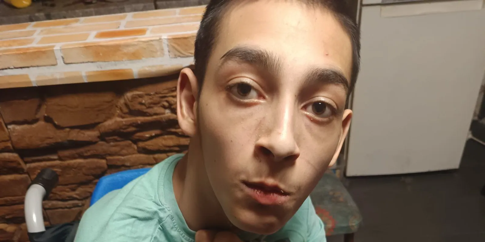 Gyula intenzív terápiára szorul, hogy önállóan járhasson