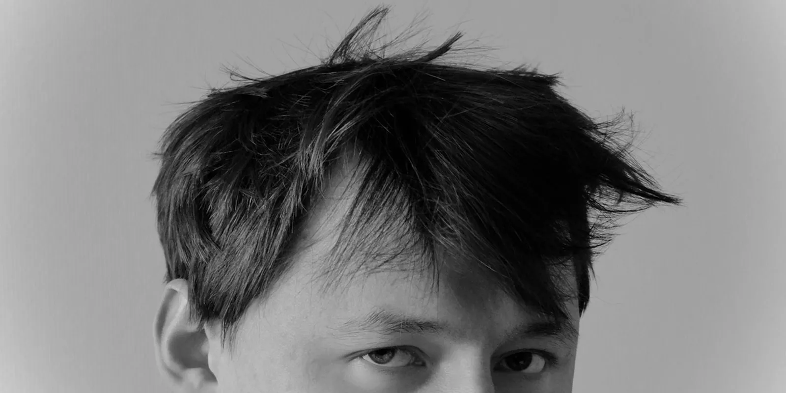 Ritka betegség miatt tépkedi ki a saját szemöldökét a férfi