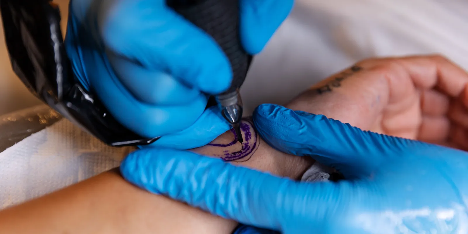 Meg akart szabadulni a tetoválásától, borzasztó mi történt