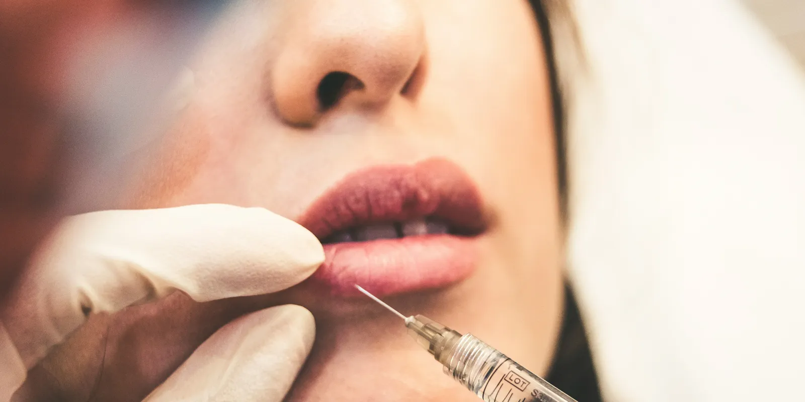 Így nézett ki a műtét előtt a világ legnagyobb arcú nője