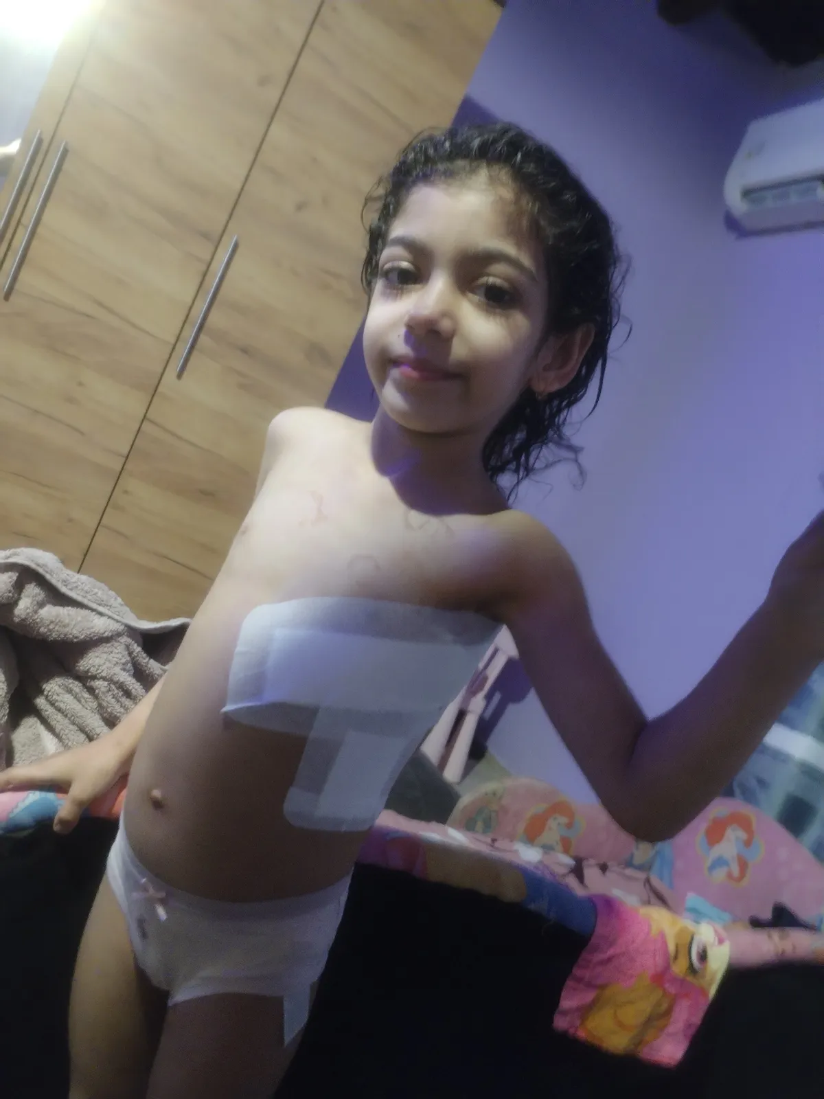 20 centiméteres nagy vágás van a testén, ahol a daganatot kioperálták belőle