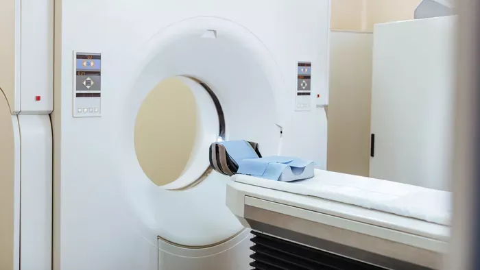 Évekig fájt a feje, golflabda méretű agydaganata nőtt