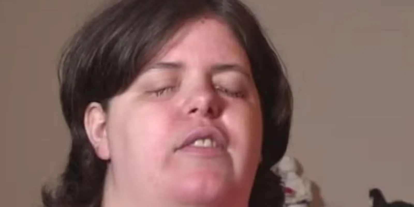 Vaknak akart születni a nő - megvalósult szélsőséges álma