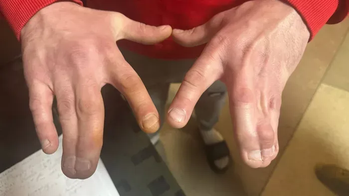 Súlyos betegeket tartanak fogva az ukrán toborzóközpontban