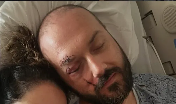 Vérző fejjel találták meg az influenszer férjét egy hotel előtt. Fotó: Instagram/biglittlefeelings