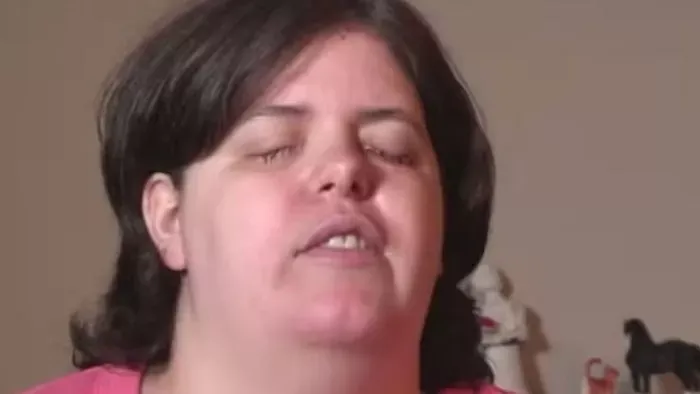 Vaknak akart születni a nő - megvalósult szélsőséges álma