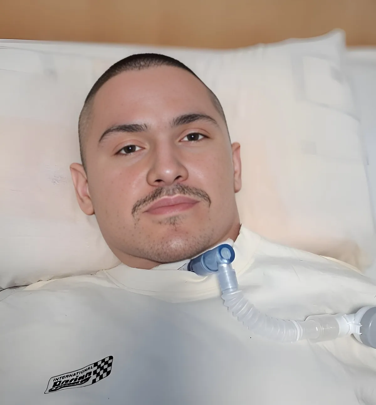 duchenne