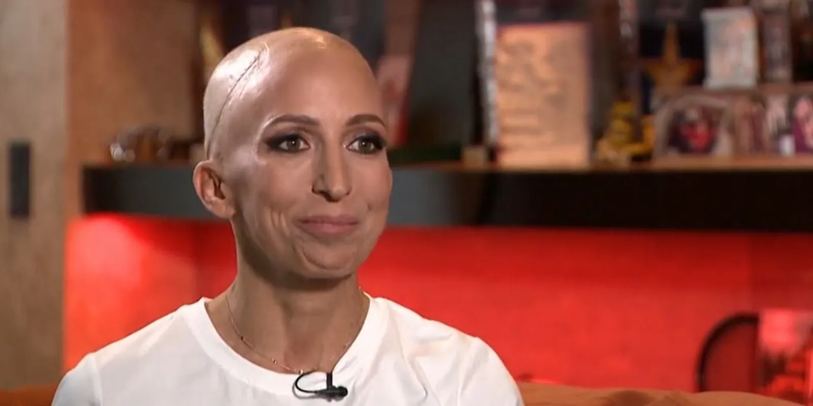 Könnyeivel küszködve vallott rákbetegségéről Rubint Réka