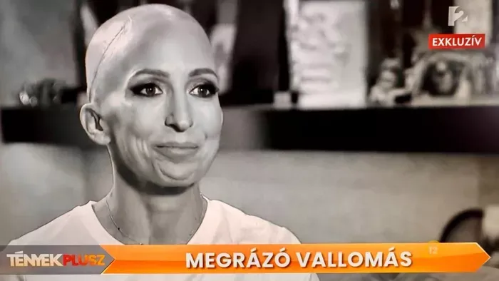 Rubint Réka rákkal küzd, végre kamerák elé áll betegségével