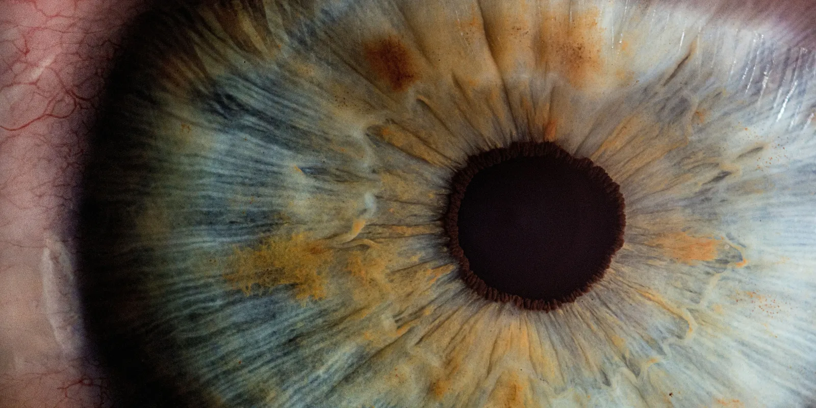 Összeomlott a fiatal anya: elnyeli a látását a sötétség