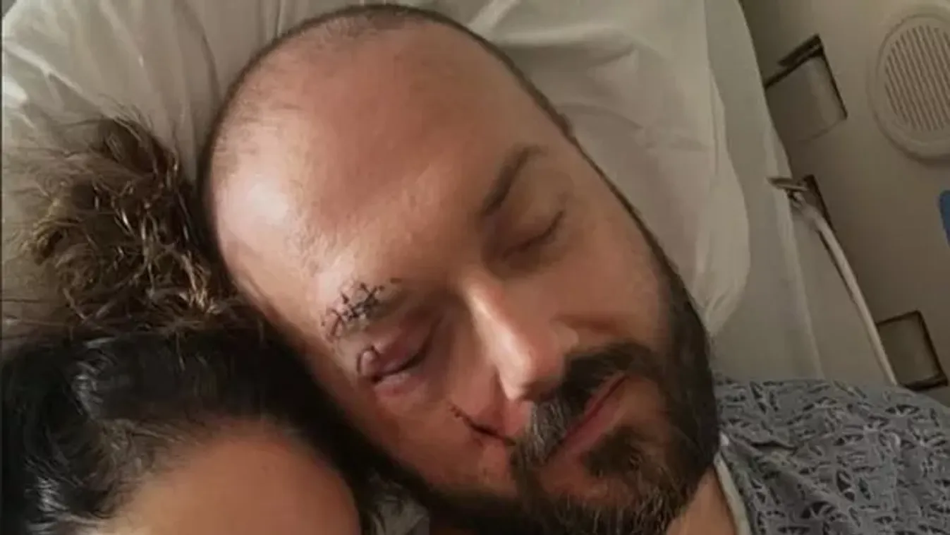 Tragédia: Vérző fejjel találták meg a férfit egy hotel előtt