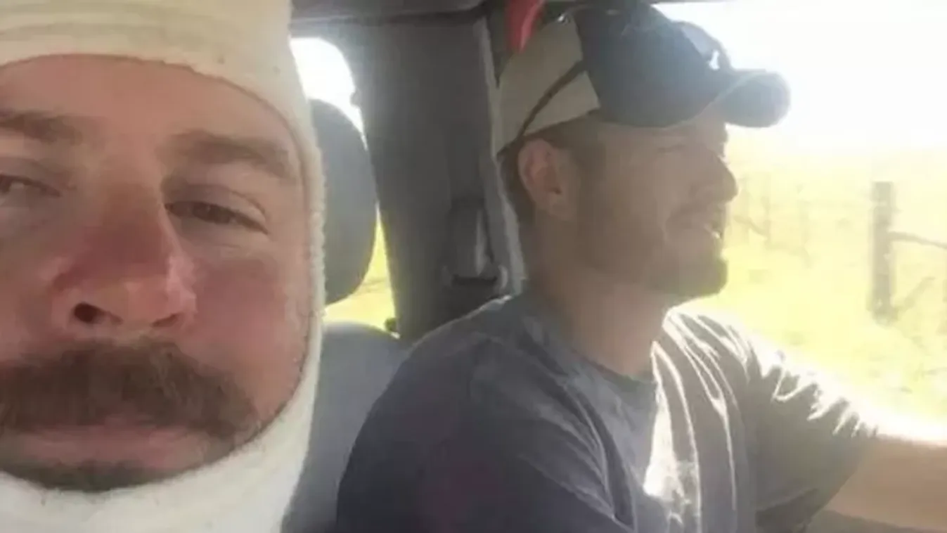 Többször újra kellett éleszteni a hős tűzoltót