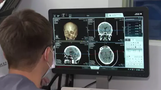 A mesterséges intelligencia csaknem felére csökkentette az agyvérzés halálozási arányát