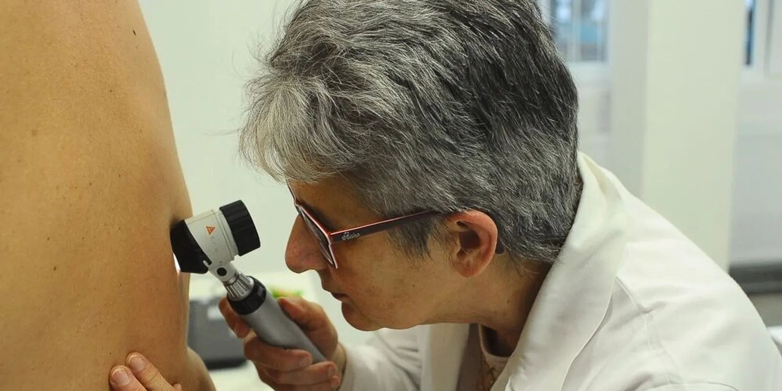 Országos bőrrákszűrési program indult – íme a helyszínek