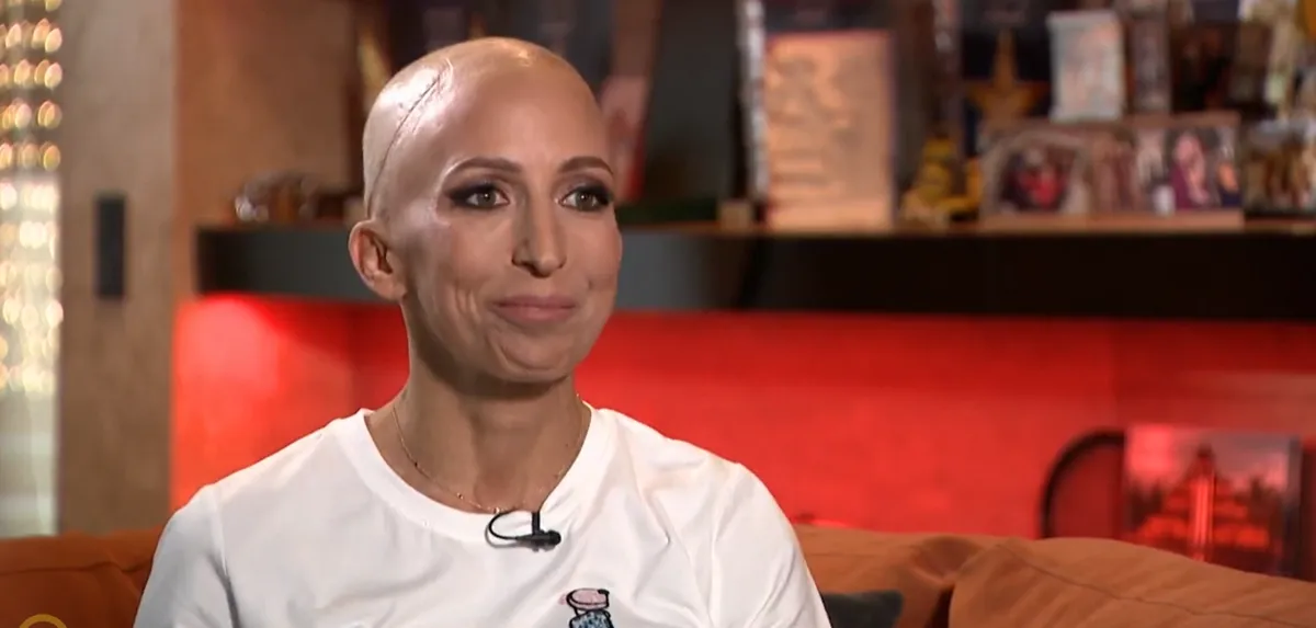 Már nem titkolja tovább: Rubint Réka a kamerák előtt vette le parókáját, megmutatva a küzdelem nyomait