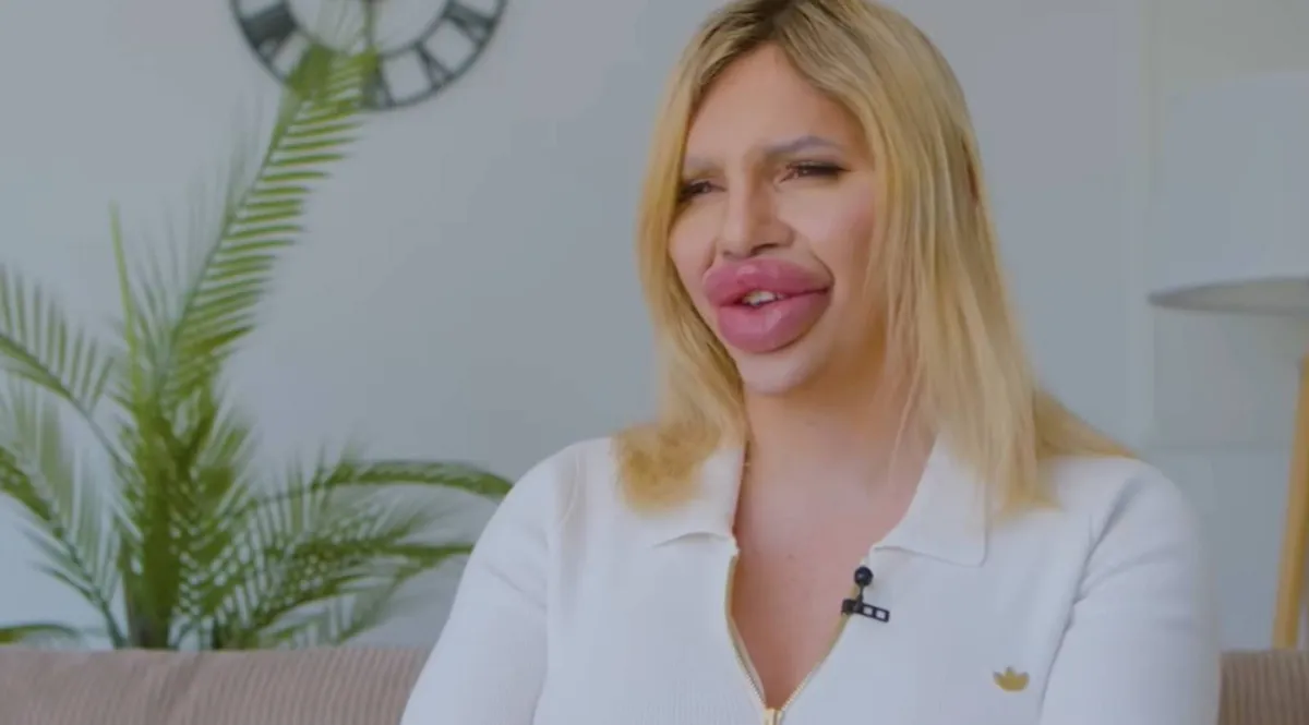 Tiniként kattant rá a plasztikára Vienna. Nem kevés szilikon van a testében