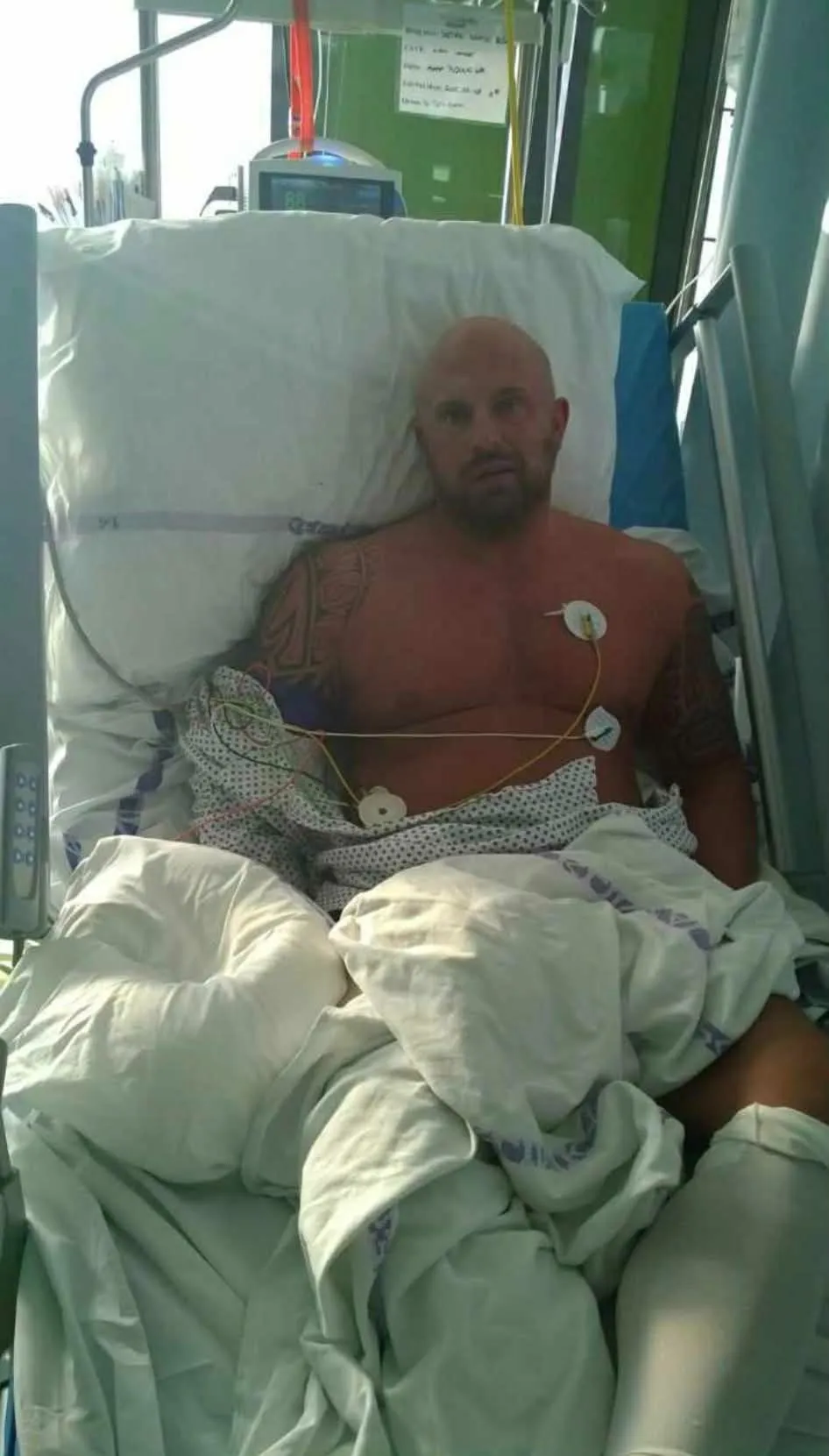 Vilmosnak újra kellett tanulnia járni és beszélni a stroke utá