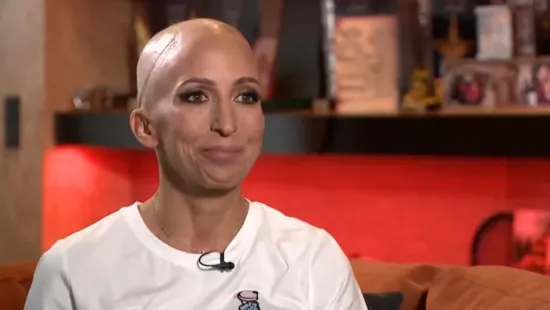 „Nem lehet, hogy egy horrorfilmnek megint én vagyok a főszereplője” – Élő adásban vette le parókáját a rákbeteg Rubint Réka