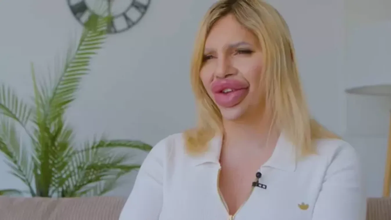 1 liter töltőanyag: "Enyém a világ legnagyobb ajka!"