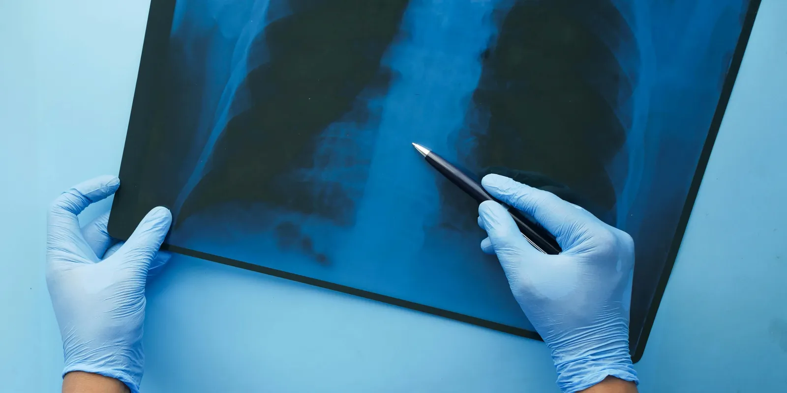 A fiatal nem tudta abbahagyni az e-cigaretta használatát