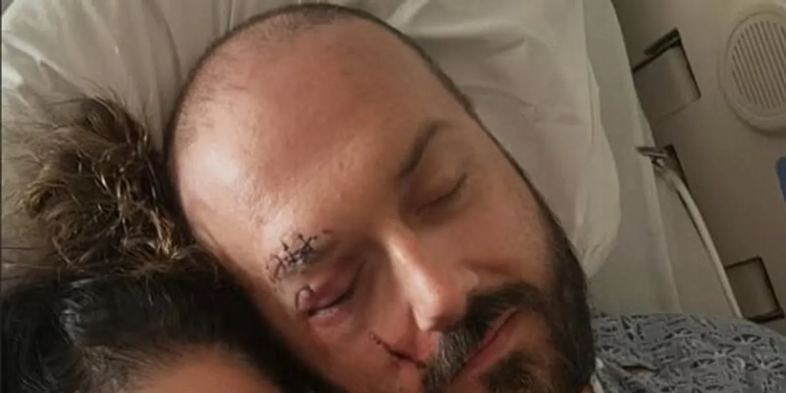 Tragédia: Vérző fejjel találták meg a férfit egy hotel előtt