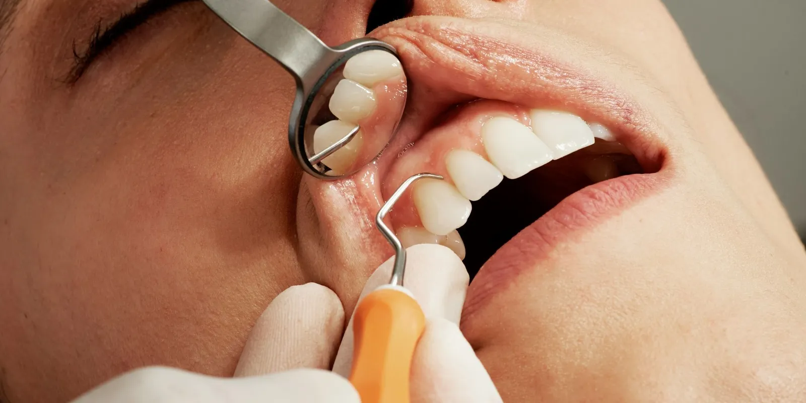 Törökországi fogai majdnem az életébe kerültek az anyának