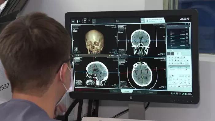 Az AI felére csökkentette az agyvérzés halálozási arányát