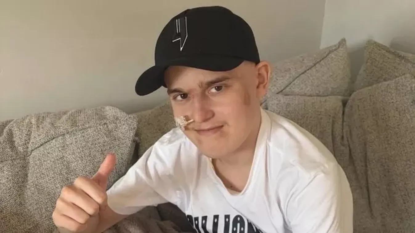 Sérülésére fogták fájdalmát, kiderült, hogy sokkal rosszabb