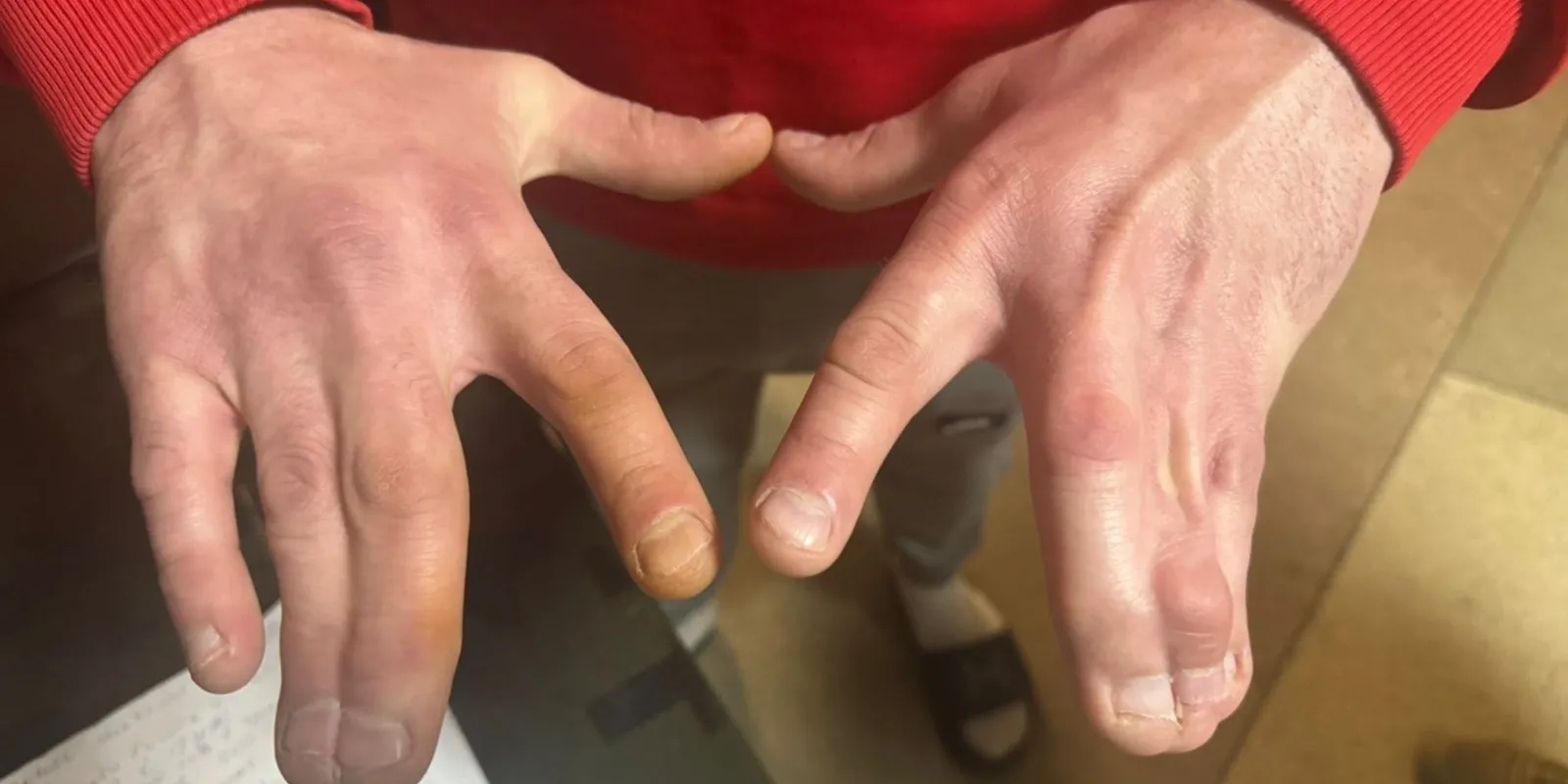 Súlyos betegeket tartanak fogva az ukrán toborzóközpontban