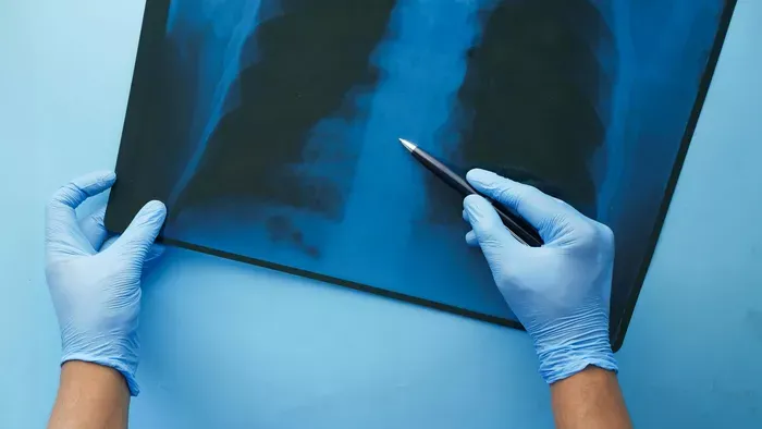 A fiatal nem tudta abbahagyni az e-cigaretta használatát