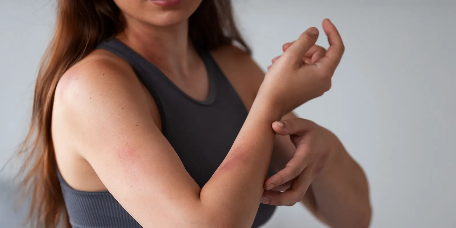 Ritka allergia tartja fogságban a nőt