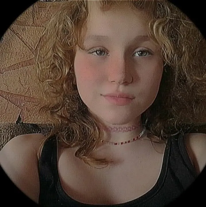 Elizának a szép hosszú haja hiányzik a legjobban 