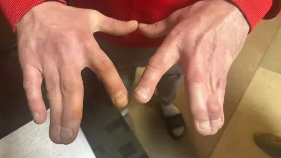 Súlyos betegeket és fogyatékossággal élőket is fogva tartanak az ukrán toborzóközpontokban