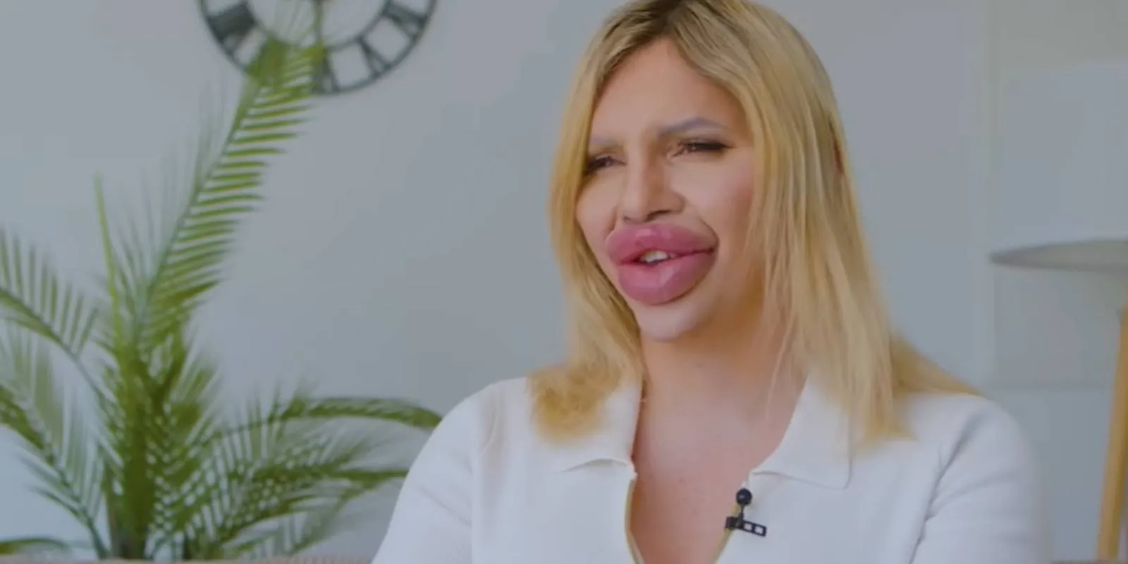 1 liter töltőanyag: "Enyém a világ legnagyobb ajka!"