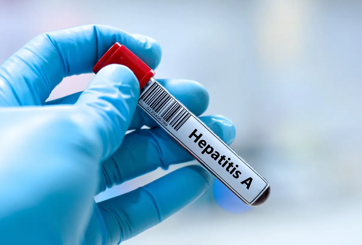 Hepatitis A vírus