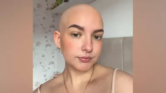 Lilli életét 20 éves korában elragadta a rák: „Csak folytassátok, menni fog”
