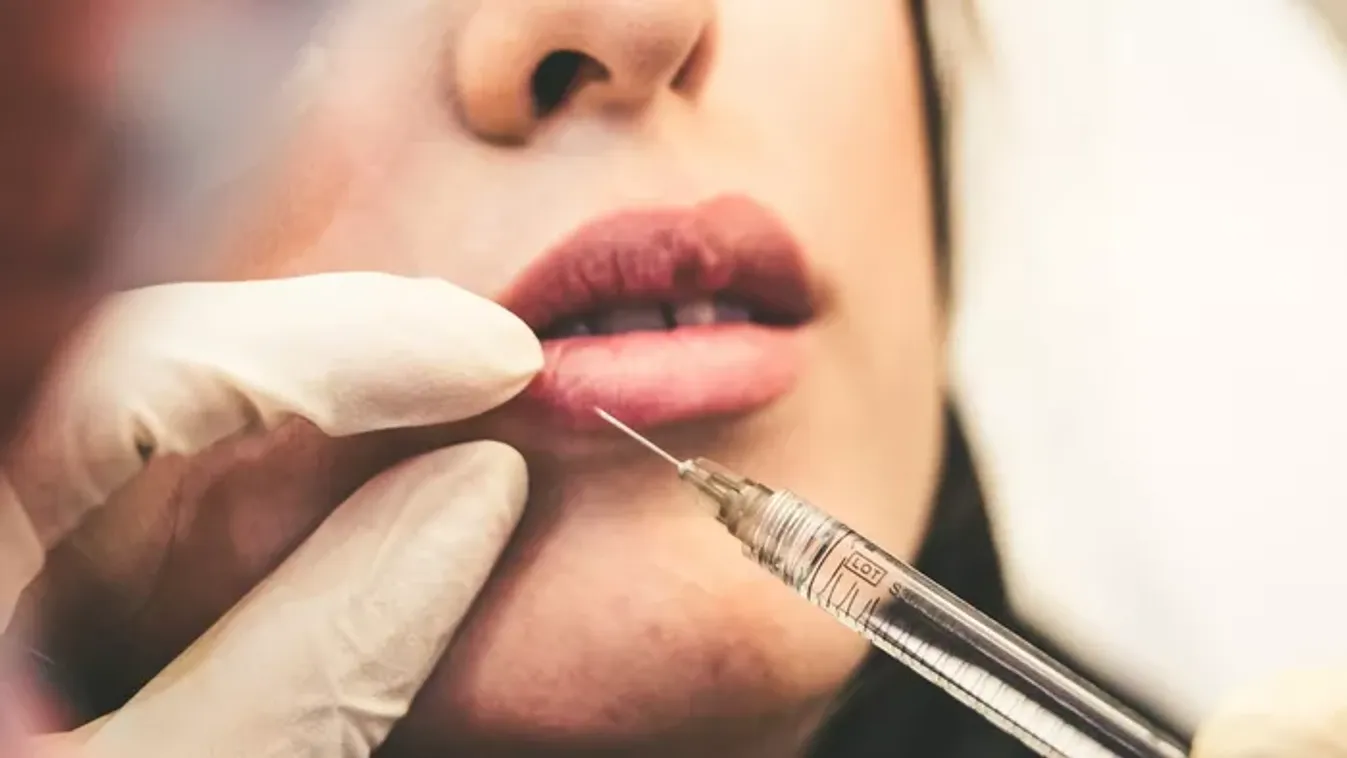 Zavarták a ráncok, majdnem megfulladt a botox miatt