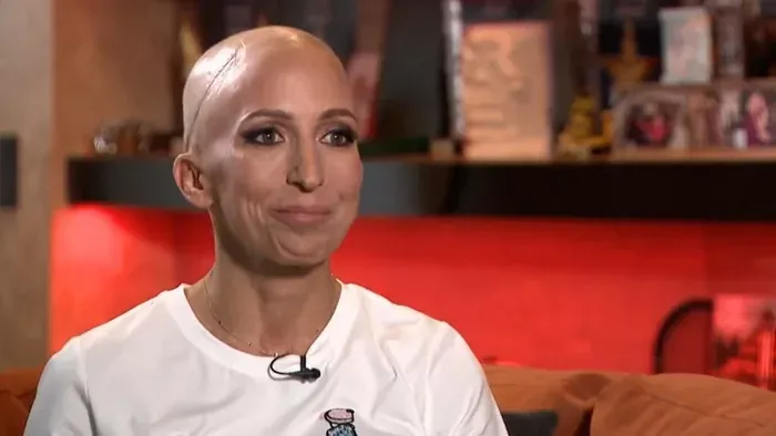 Nőtt Rubint Réka daganata, áttét miatt vizsgálják